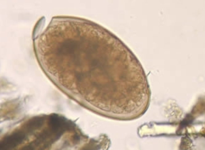 <p>What type of parasitic worm is this?</p>