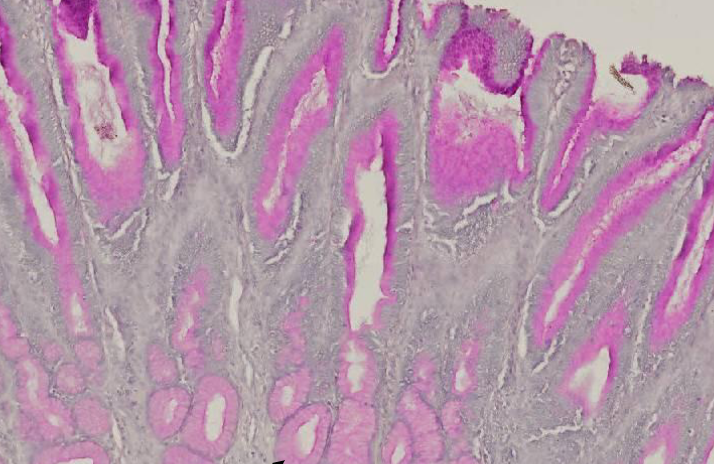 <p>welk soort weefsel?</p>