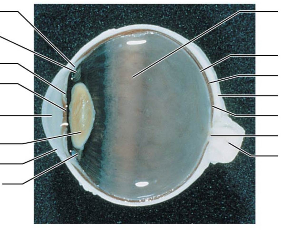 <p>second arrow on left</p>