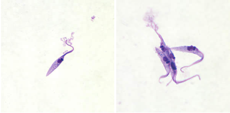 <p>Trypanosoma cruzi, epimastigote</p><p>Disease: <u>Chagas disease</u></p><p>Vector: <u>Triatomine/kissing/reduviid bug</u></p><p>Transmission: <u>bugās feces</u></p><p>Infective stage: <u>Metacyclic trypomastigote</u></p><p>Diagnostic stage: <u>Trypomastigote</u></p><p>Treatment: <u>Benznidazole and/or Nifurtimox</u></p>