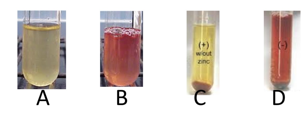 <p>Nitrate Reduction Test</p><p>a) Medium?</p><p>b) Substrate?</p><p>c) Enzyme?</p><p>d) Indicator/Reagent?</p><p>e) End Product?</p>