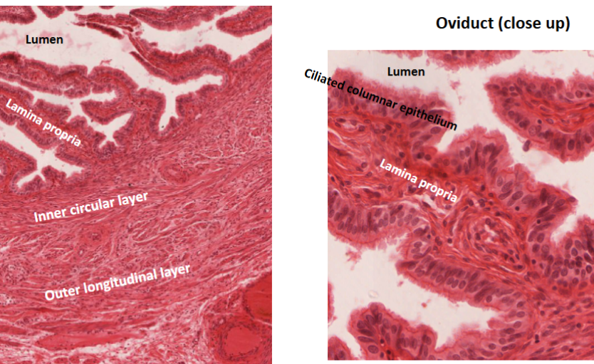 <p>Infundibulum - hold ovary in place (CT)</p><p>Ampulla - trumpet shape (SITE OF FERTILIZATION)</p><p>Isthmus - straightened out part</p><p>Intramural regions - aka fundus</p>