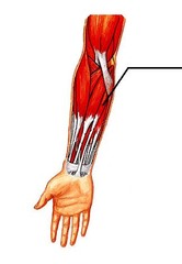 <p>A muscle that assists in flexing the wrist.</p>
