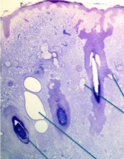 <p>identify gland of zeiss and moll and eyelash follicle on a microscopic image</p>
