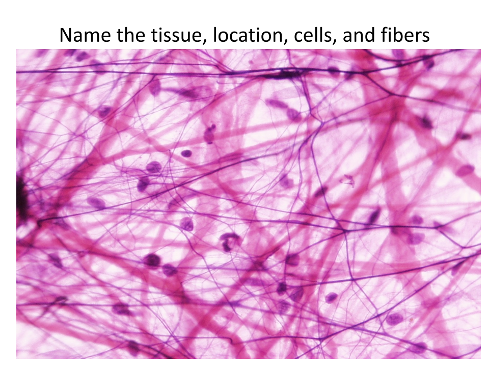 <p>What are the cells of this tissue?</p>