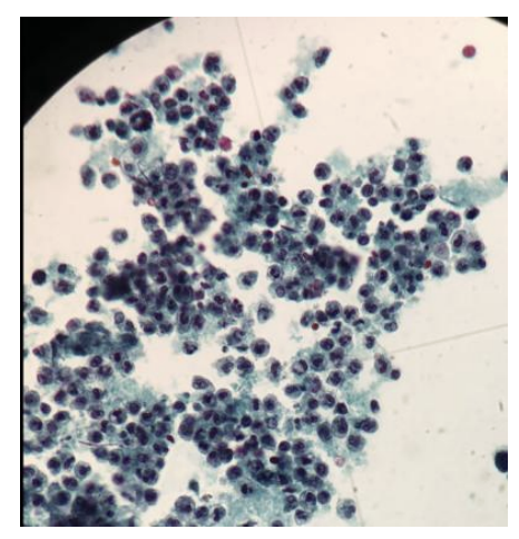 <p>seen in stool microscopic examination</p>