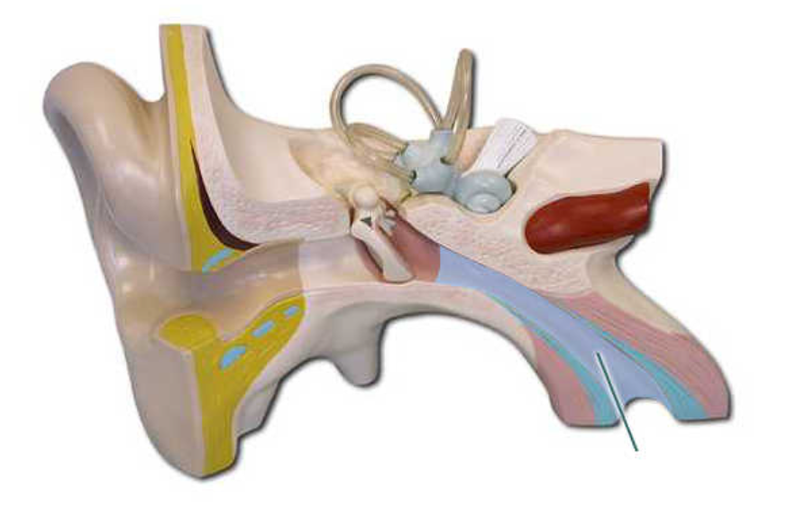term image