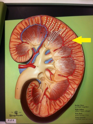 term image