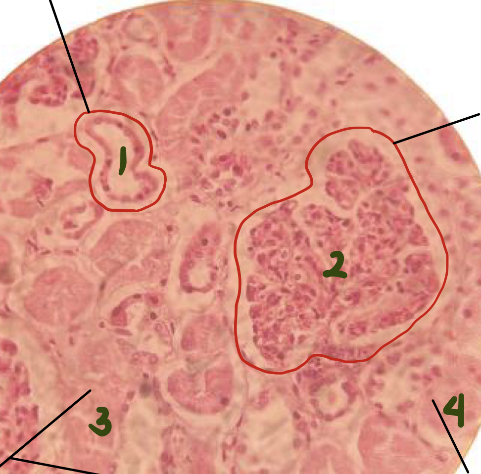 <p>diagnose and identify the pointed structure</p>