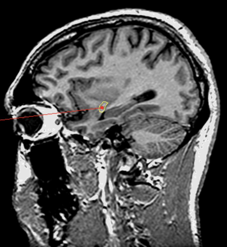 <p>What is the area highlighted called?</p>
