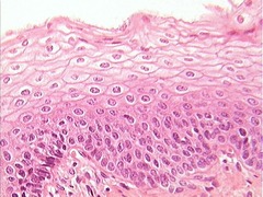 <p>A body tissue that covers the surfaces of the body, inside and out</p>