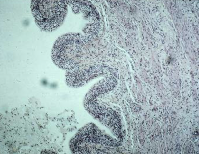 <p>tissue type </p>