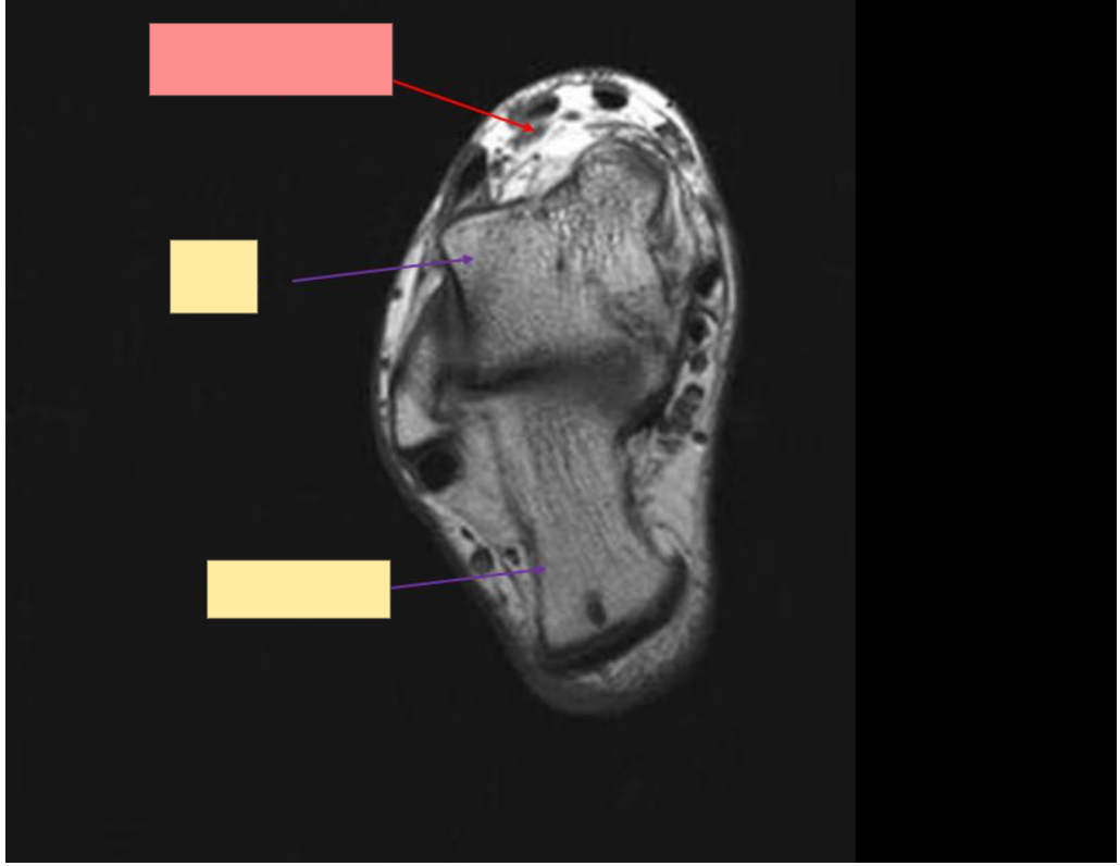 <p>Identify the structure</p>