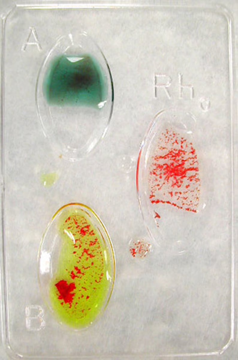 <p>What type of blood is this?</p>