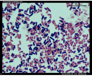 <p>which species has the following characteristics:</p><ul><li><p>gram stain: straight bacilli with square ends (“<strong>box-car</strong>”) in chains and singly </p></li><li><p>cultures: large, flat colonies “<strong>ground glass</strong>”</p></li></ul><p></p>
