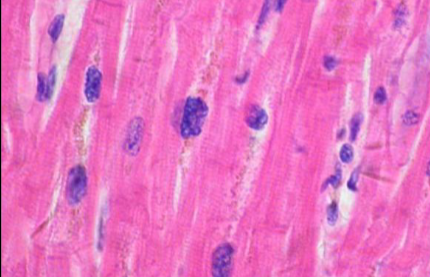 <p>Has very slow contractions, is involuntary, and autorhythmic</p>