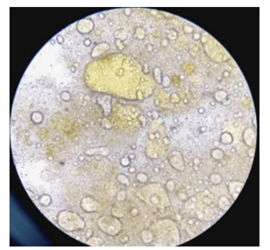 <p>seen in stool microscopic examination</p>