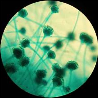 <p>This type of fungi has a stalk followed by a spherical tip that’s mop-like; reproduce from sproangiospores</p>