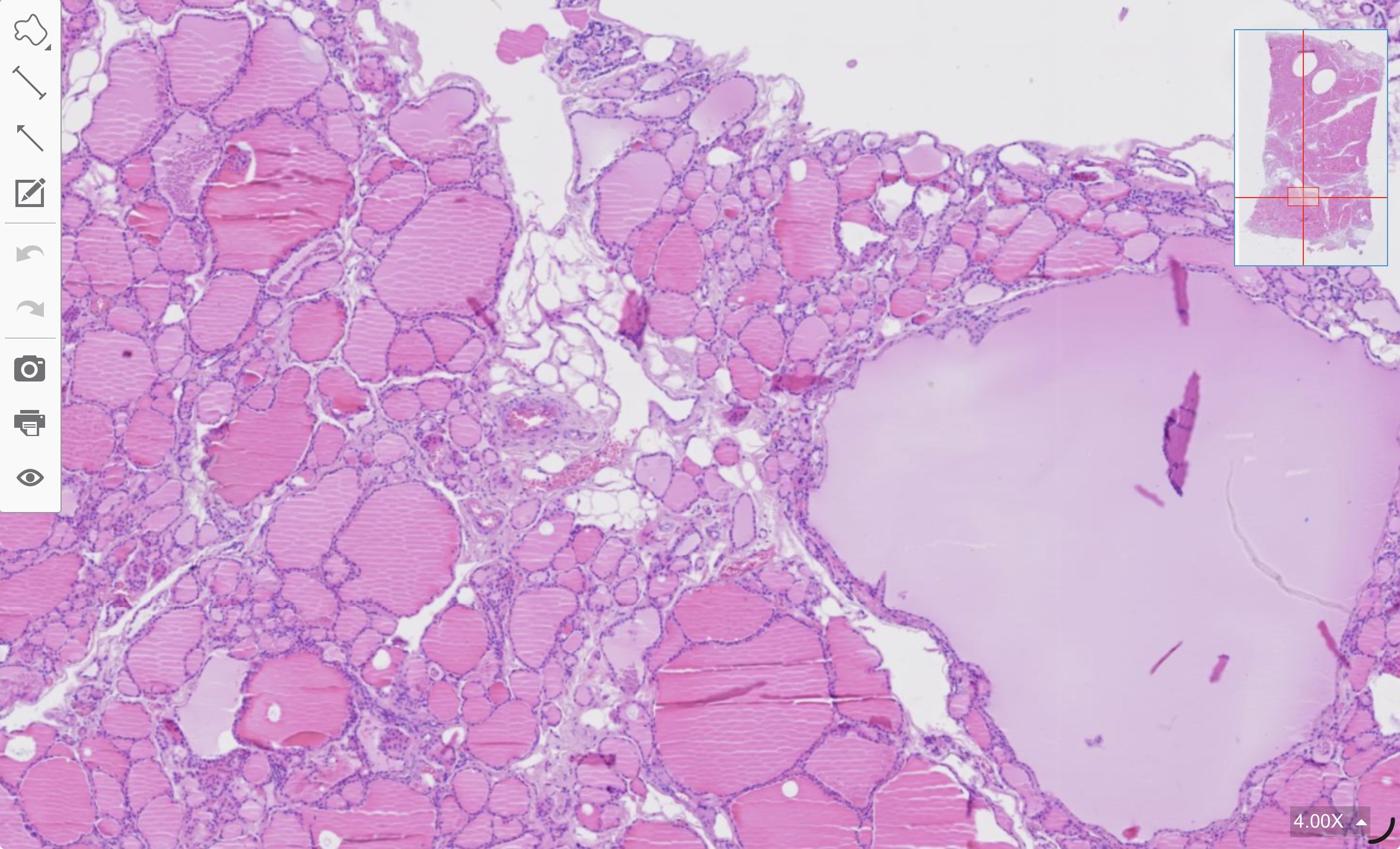 term image