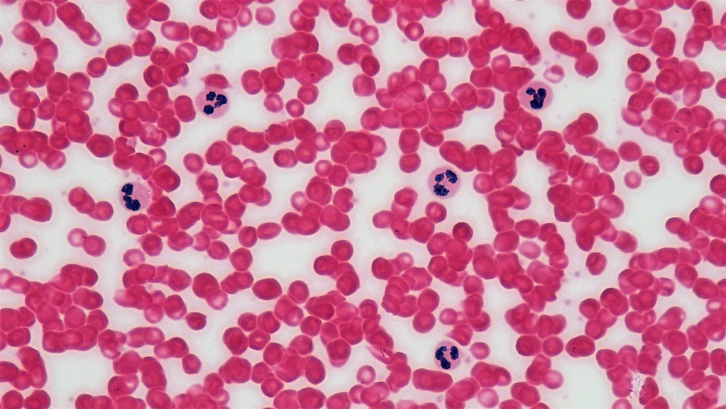 <p>What type of tissue is this?</p>