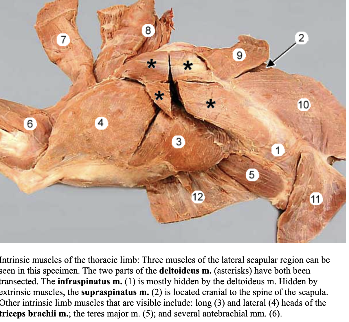 <p>attachment: supraspinous fossa of the scapula and greater tubercle of the humerus</p><p>action: extend and stabilize the shoulder </p><p>nerve: subscapular nerve </p><p>blood: subscapular artery </p><p></p>