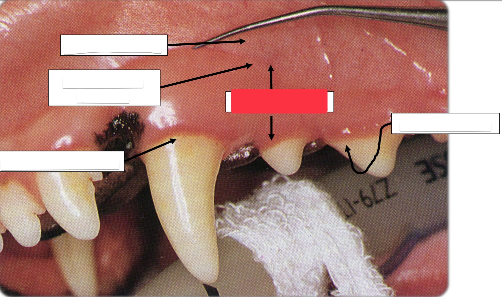 <p>Label this part of the gingiva.</p>