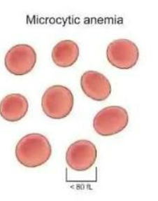 <p>MICROCYTIC</p>
