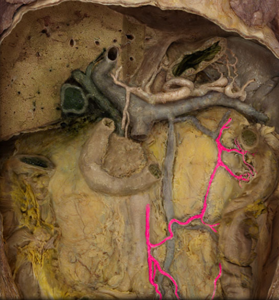 <p>With its branches</p>