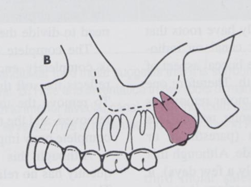 <p>what angle is this?</p>