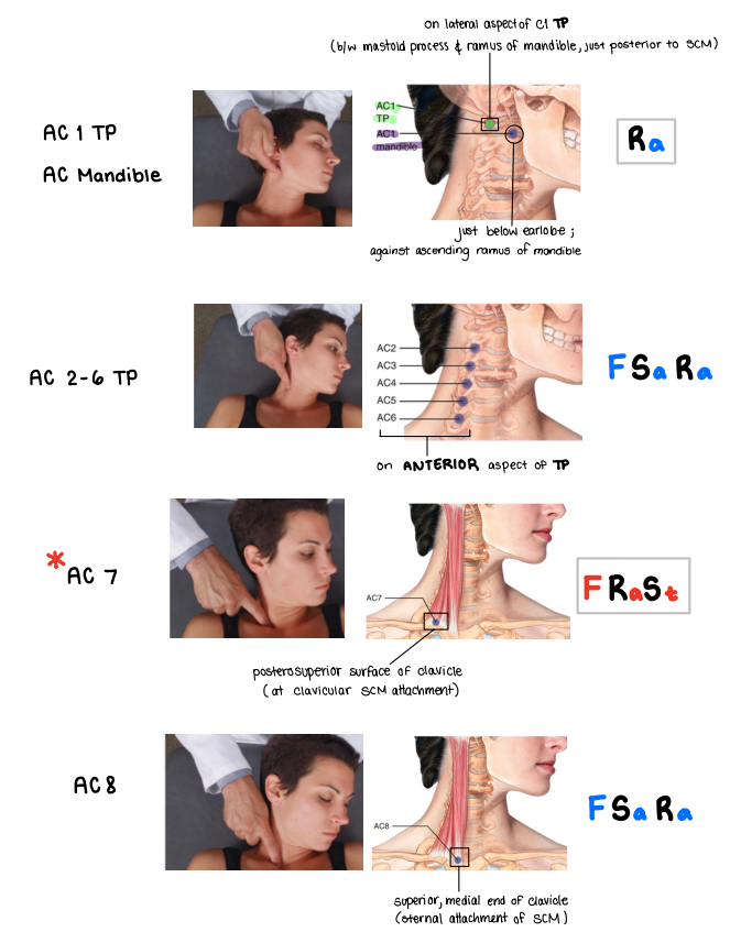 <p>Patient will be supine!</p><ul><li><p>AC1 = Ra (TP or mandible)</p></li><li><p>AC2-C6 TP = FSaRa (posterior to SCM)</p></li><li><p>AC7 = FStRa (posterior/superior surface of clavicle)</p></li><li><p>AC8 = FSara (medial end of clavicle)</p></li></ul><p></p>
