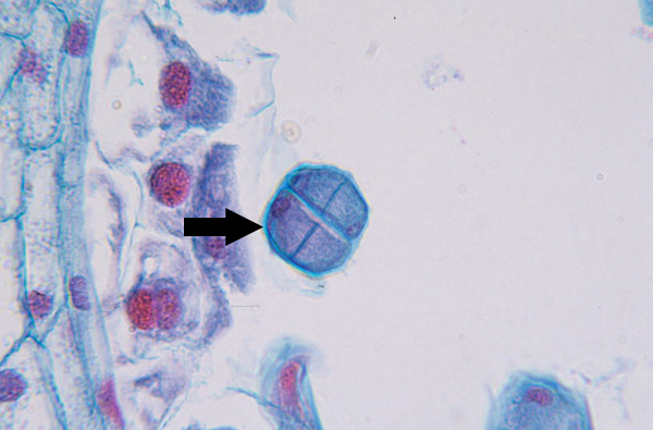 <p>Nuclear membrane reforms, and chromatin decondenses, and cell plate begins to form</p>