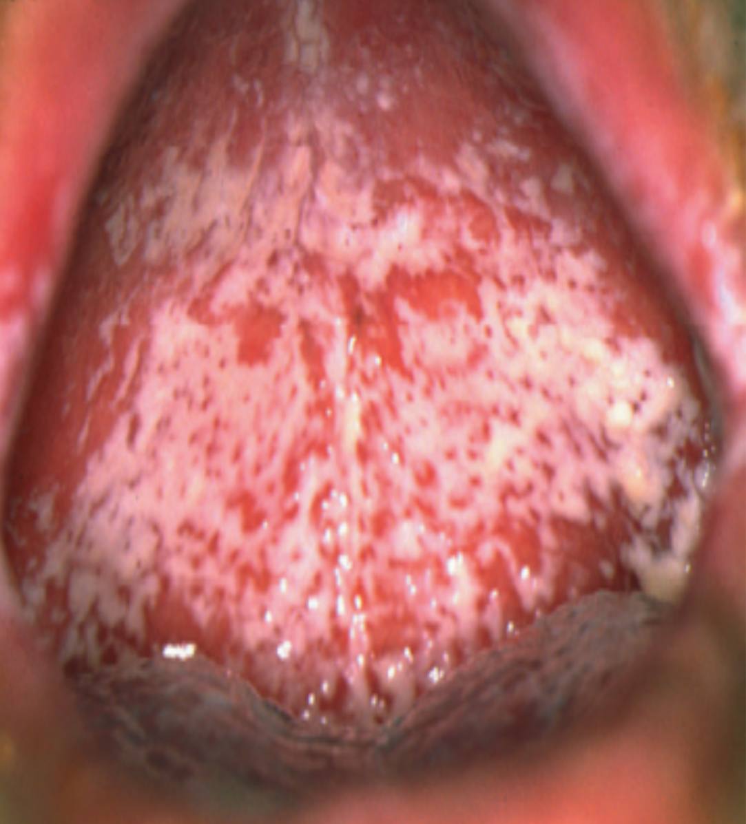 <p>• Name of lesion:</p><p>• Causative organism:</p><p>• Describe the lesion:</p>