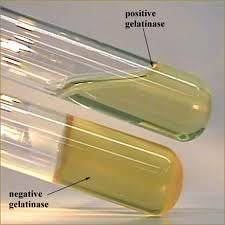 <ul><li><p>Detects gelatinase, which breaks down gelatin into smaller amino acids, causing the media to lose its ability to solidify at cold temperatures </p></li><li><p>Positive: medium remains liquid after chilling </p></li><li><p>Negative: medium solidifies upon chilling </p></li></ul><p></p>