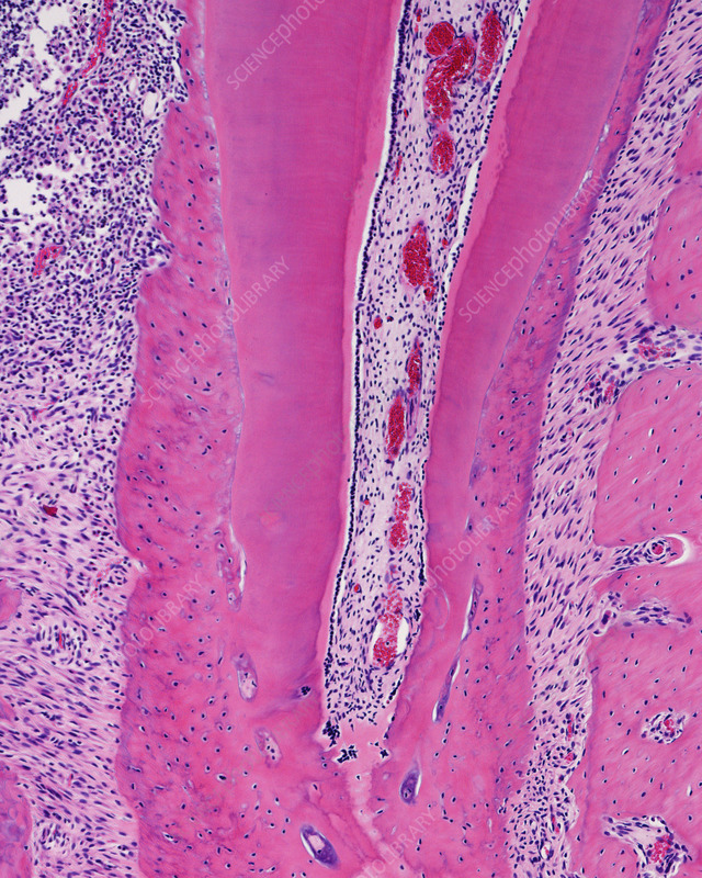 <p>root of tooth </p>