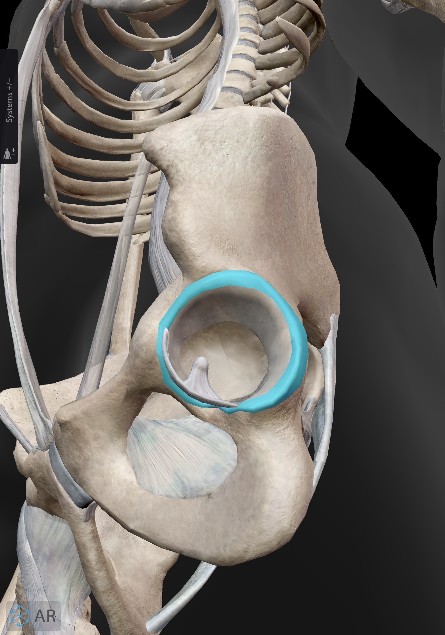 <p>What joint accessory is this?</p>