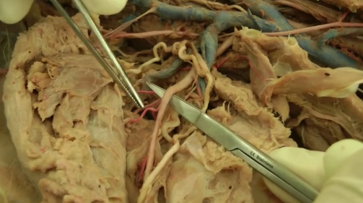 <p>Name of major arterial trunk in brachium</p>