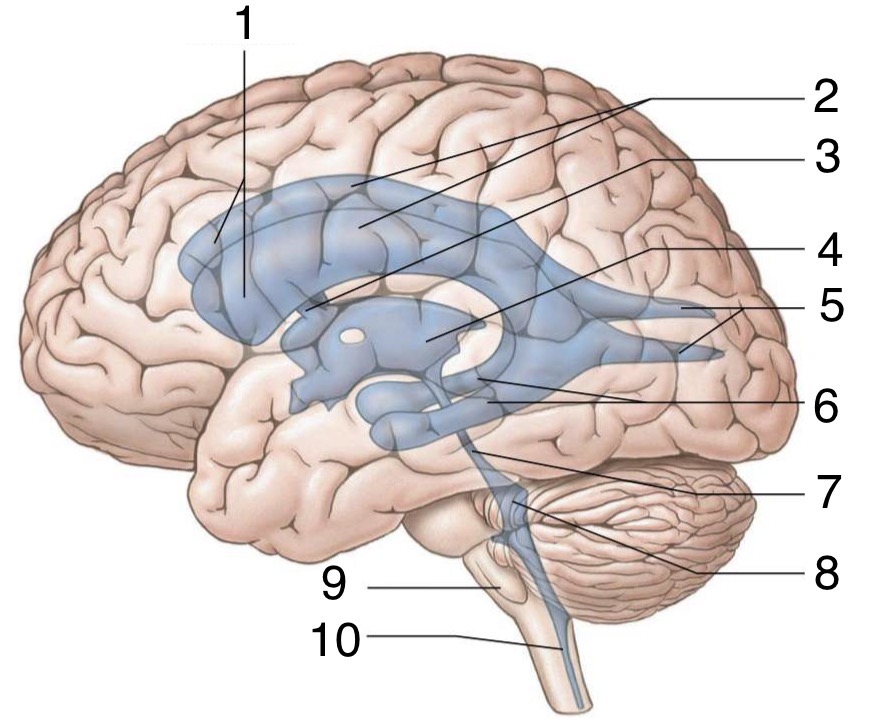 <p>Label the Ventricles and other parts of the Brain</p>