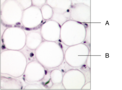 <p>A: fat cell</p>