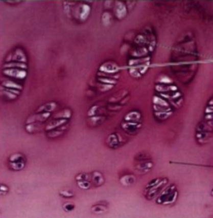 <p><span style="background-color: transparent;">Supporting Connective Tissue: Is this Fibrocartilage, </span>Hyaline Cartilage, or <span style="background-color: transparent;">Elastic Cartilage?</span></p><ul><li><p>Location:</p></li><li><p>Attributes: </p></li></ul><p></p>