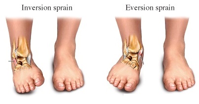 <p><strong>unique to feet; </strong>inward and outward turning of the sole of the foot </p>
