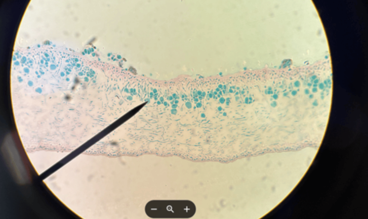 <p>What is the green part?</p>