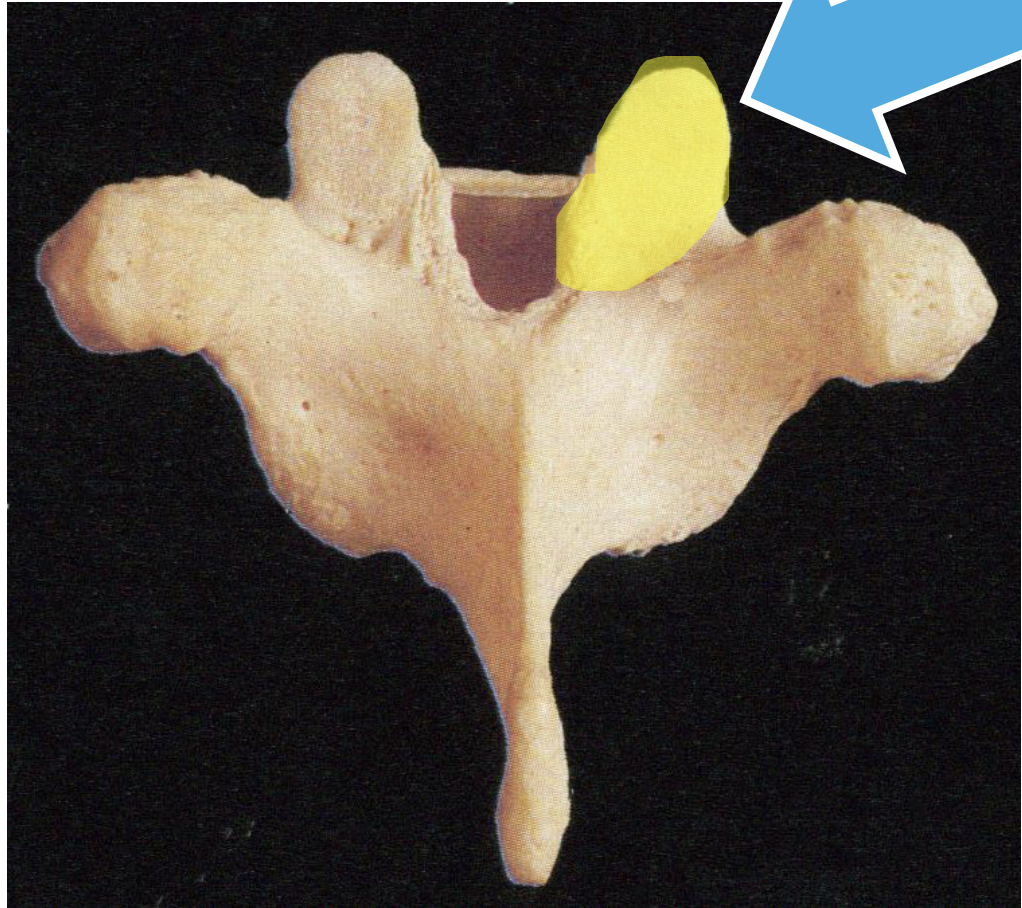 <p>General feature of all three types of Vertebrae</p>