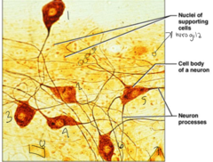 <p>What type of tissue is this?</p>