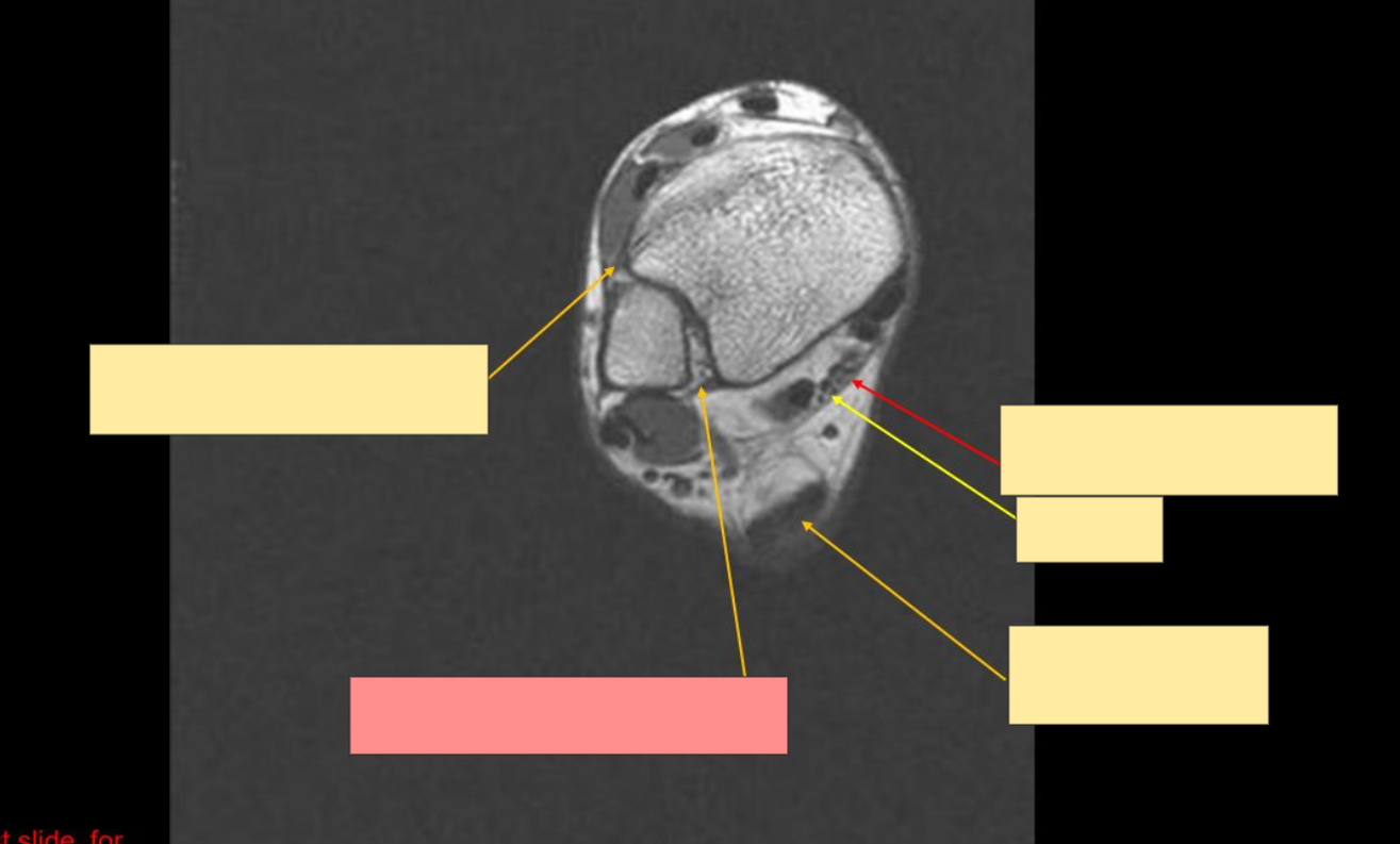 <p>Identify the structure</p>