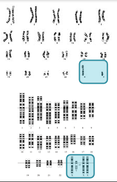 <ul><li><p>chromosomes that are different in men and women</p></li><li><p>X and Y</p></li><li><p>Y contains genes that determine male sex and little else</p></li><li><p>X contains A LOT of genes that have nothing to do with SEX DETERMINATION</p><ul><li><p>color blindness, hemophilia, muscular dystrophy</p></li></ul></li></ul><p></p>