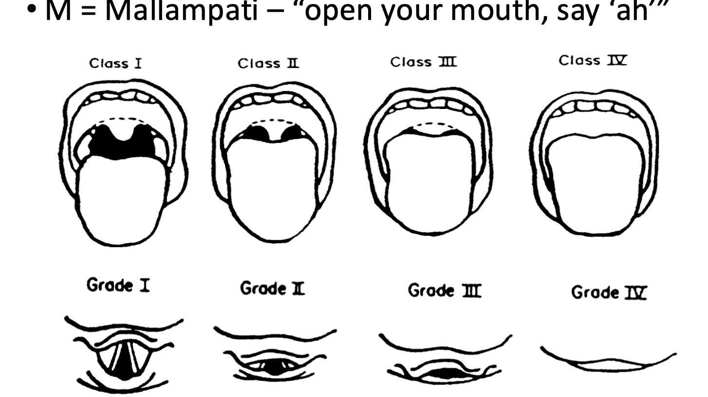 <p>LEMON</p><p></p><p>L- Look- evidence of difficult airway, trauma, teeth issues, facial hair, tongue, piercings</p><p>E- Evaluate- Interdental distance (3 fingers is good), hyomental distance (3), thyrohyoid distance (2)</p><p>M- Mallampati- say “ah”, what structures you can see. class/grade of 1-4</p><p>O- Obstruction- airway swelling soft tissues, trauma, piercings, etc</p><p>N- Neck mobility- can they move their neck to align axis</p>