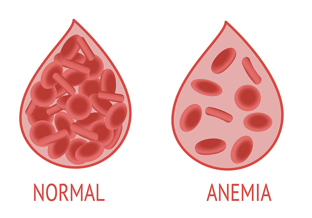 <p><span>•Found most easily in fish, meat, poultry; also in fruits, grains, vegetables, nuts, and dried beans</span></p><p><span>•Lack of iron associated with iron deficiency anemia, associated with fatigue and weakness</span></p><p><span>•Iron-deficient pregnant women have an increased risk of giving birth to a premature or low birthweight baby, or hemorrhaging and dying in child birth</span></p>