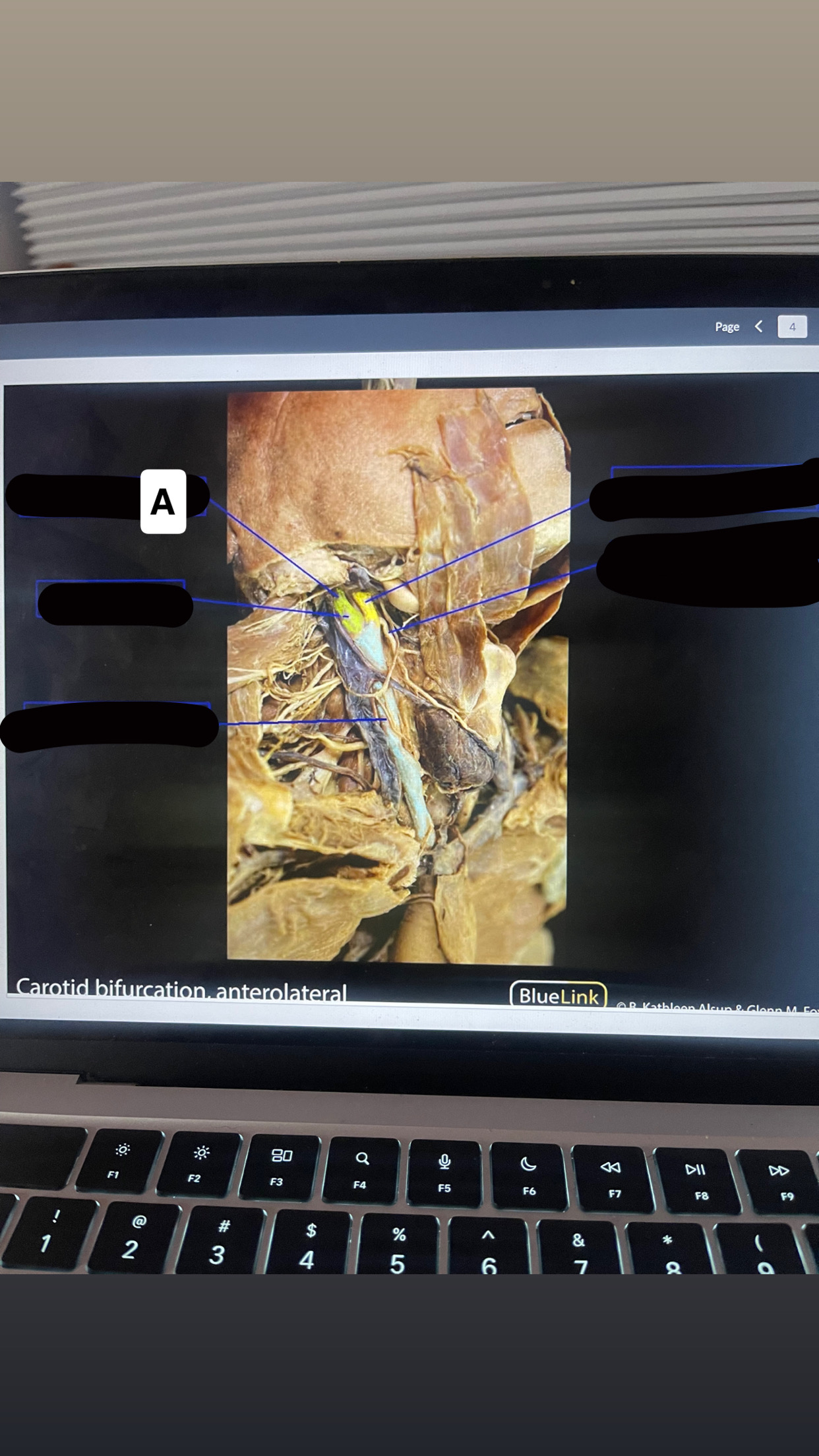 <p>Identify vessel letter A</p>
