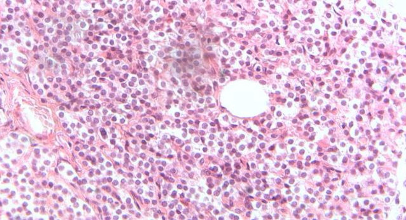 <p>What tissue/gland is this and what hormone does it secrete? </p>