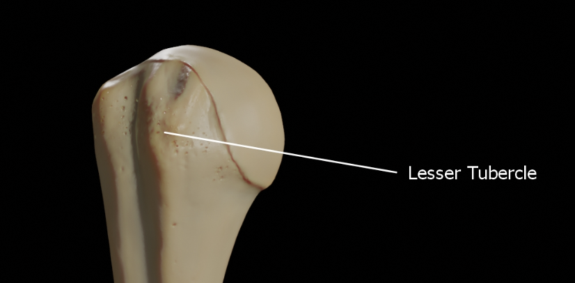 <p>Small bump</p>